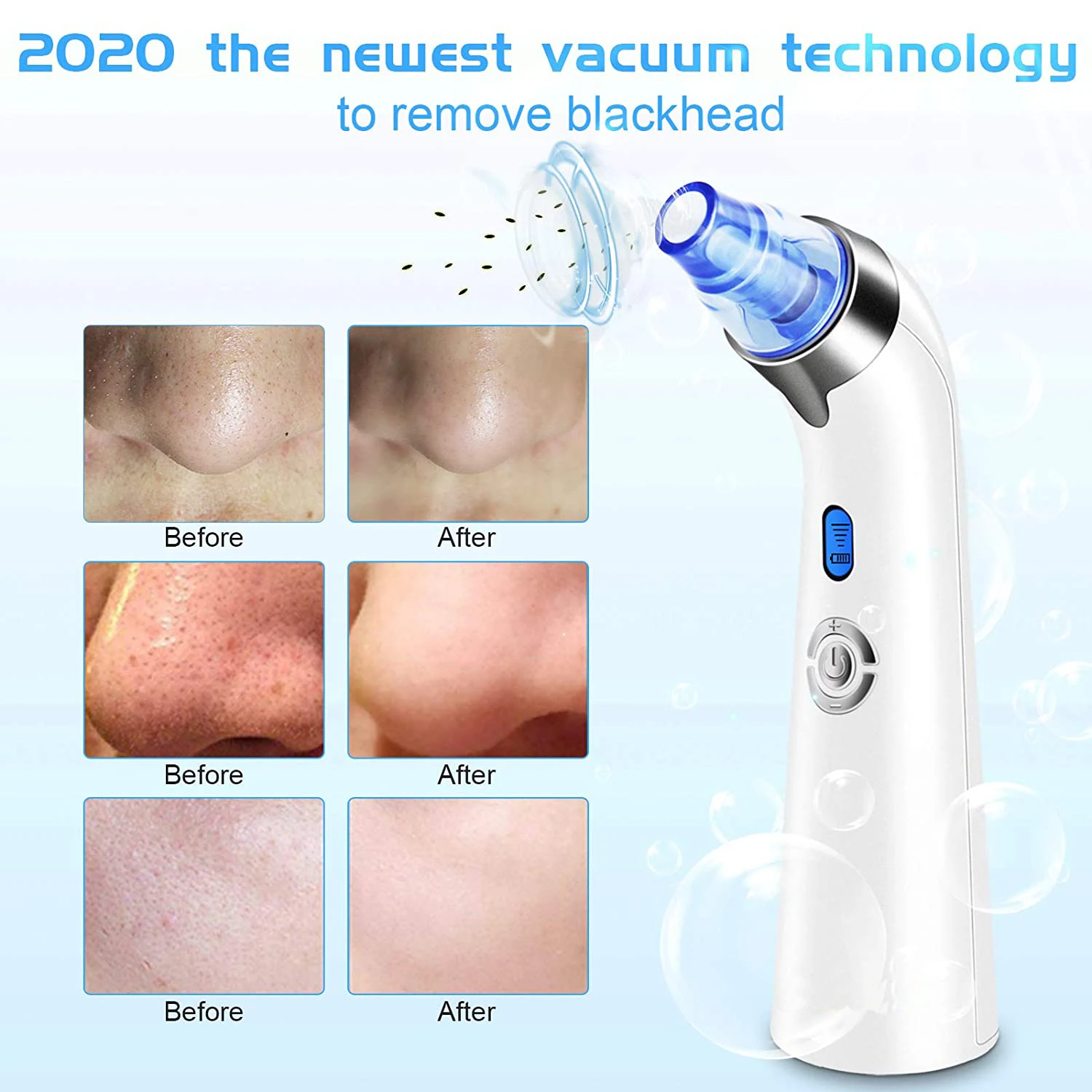

Electric Blackhead Suction Device Blackhead Removal Device Micro Crystal Household Pore Cleaner