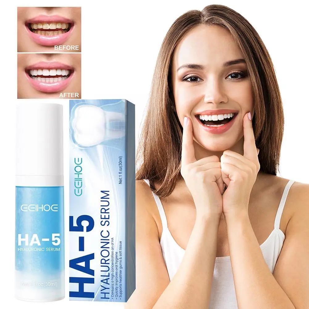 

30ml Toothpaste Mousse Cleaning Whitening Remove Yellow Remove And Oral Decay Prevent Stains Teeth Cleaning Tooth Hygiene T S0Z8
