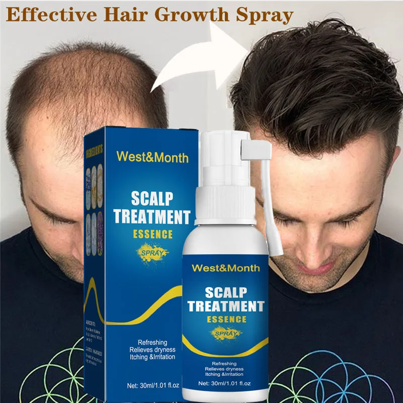 

Powerful Hair Growth Serum Spray Anti Alopecia Treatment Essence Fast Repair Nourish Hair Roots Regrowth Hair Product Men Women
