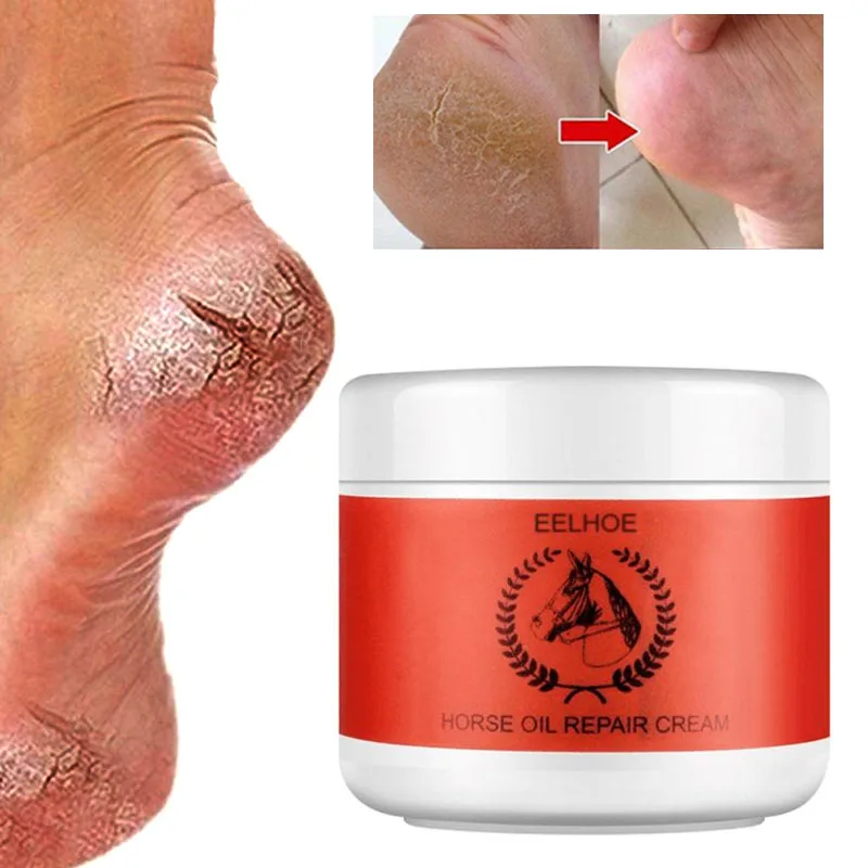 

Крем для ног с конским маслом против трещин, Маска Для Сухости пяток, восстанавливающий крем с трещинами для удаления мозолей и омертвевшей ...