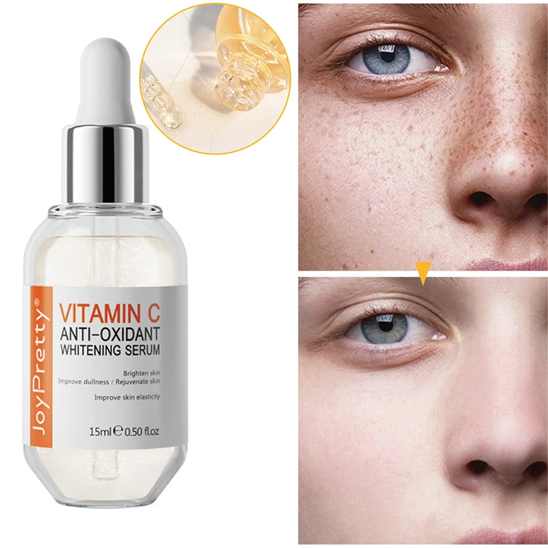 

Vitamin C Freckle Whitening Face Serum Fade Dark Spot Brighten Removal Pigment Melanin Correcting Face Essence Beauty Skin Care