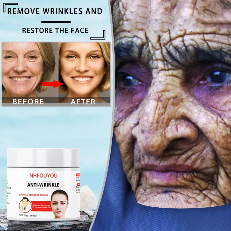 

retinol lifting cream hardening remove wrinkles anti-aging fades fine lines face whitening illuminate skin beauty health care30g
