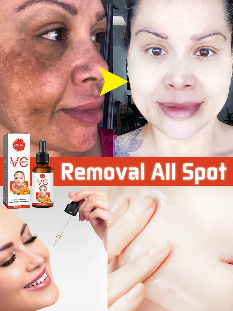 

Dark Spot Remover Face Remover Spots Essence Chloasma Age Sun Spots