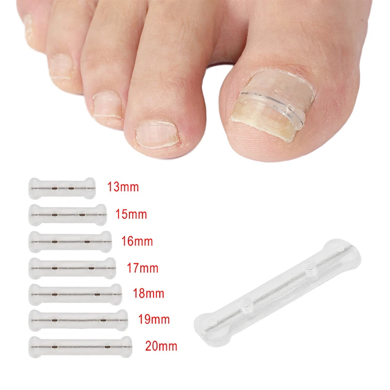 

Инструмент для коррекции вросших ногтей, средство для лечения вросших ногтей, наклейка, зажим для выпрямления, инструмент для педикюра