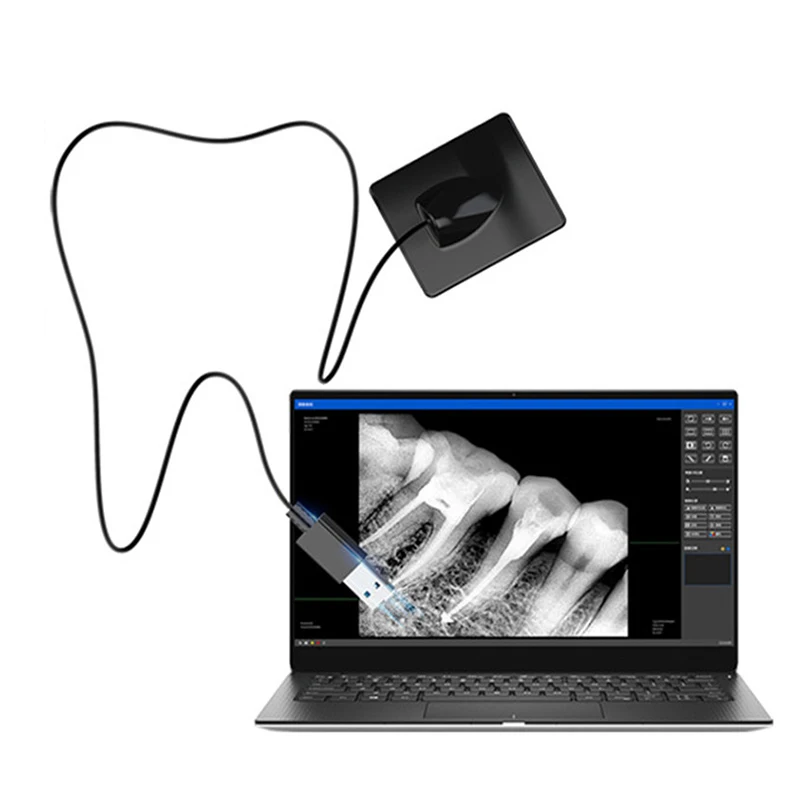 

High Quality Dental Digital RVG Intraoral X-Ray Sensor