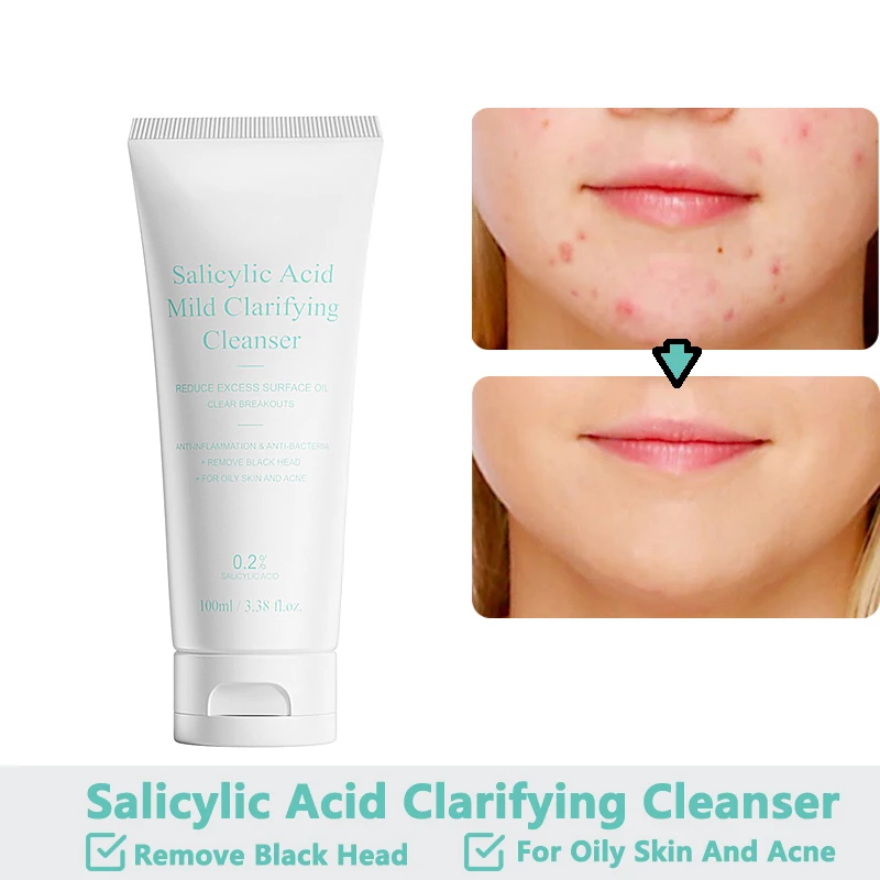 

Cleanser for Face Blackhead Remover Salicylic Acid Acne Facial Cleansing Against Blackheads Hydrating Brightening Skin Care