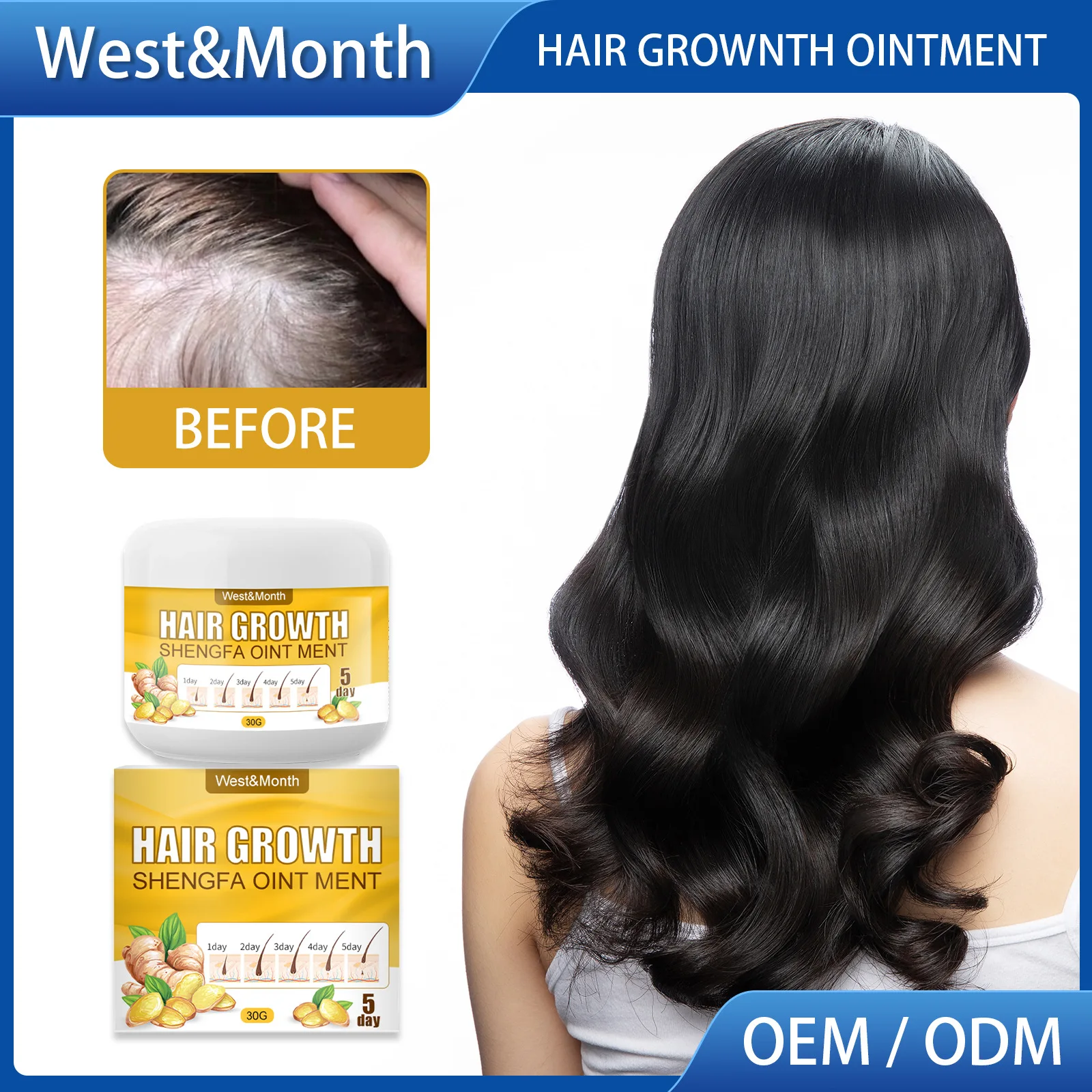 

Ginger Hair Growth Essence 7 Days Germinal Hair Growth Serum Essence Oil Hair Loss Treatment Growth Hair for Men Women