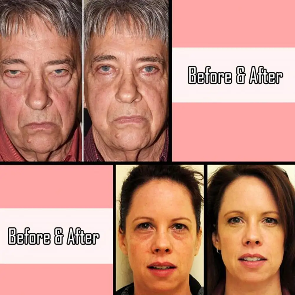 

Firming Instant Dark Circles Removing Eye Cream Liquid Pump Anti-wrinkle Skin Liquid Pump