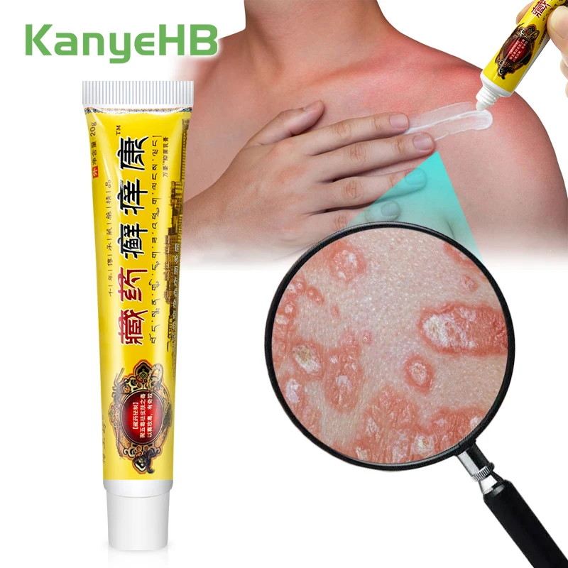 

1pcs Psoriasis Ointment Rash Eczema Dermatitis Medical Cream Anti-itch Inhibit Fungi Menthol Herbal Treat Psoriasis Cream S050