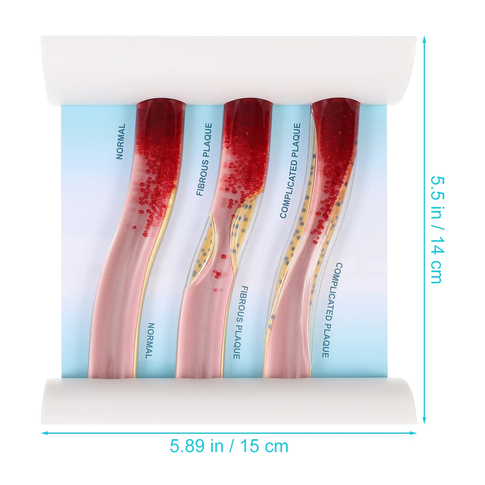 Рисунок 4 - Динамическая модель кровяного липида