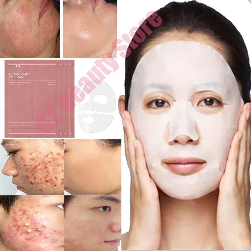 Мерная Сыворотка для восстановления красных полос крови исчезает шрамы от акне