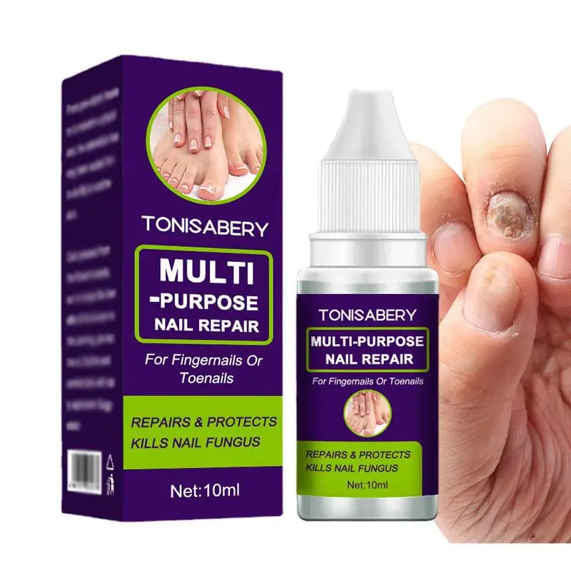 

Средство для усиления и роста ногтей на ногах, средство для лечения и устранения ногтей, эссенция для обновления, Осветляющий раствор для ногтей для обесцвеченных ногтей