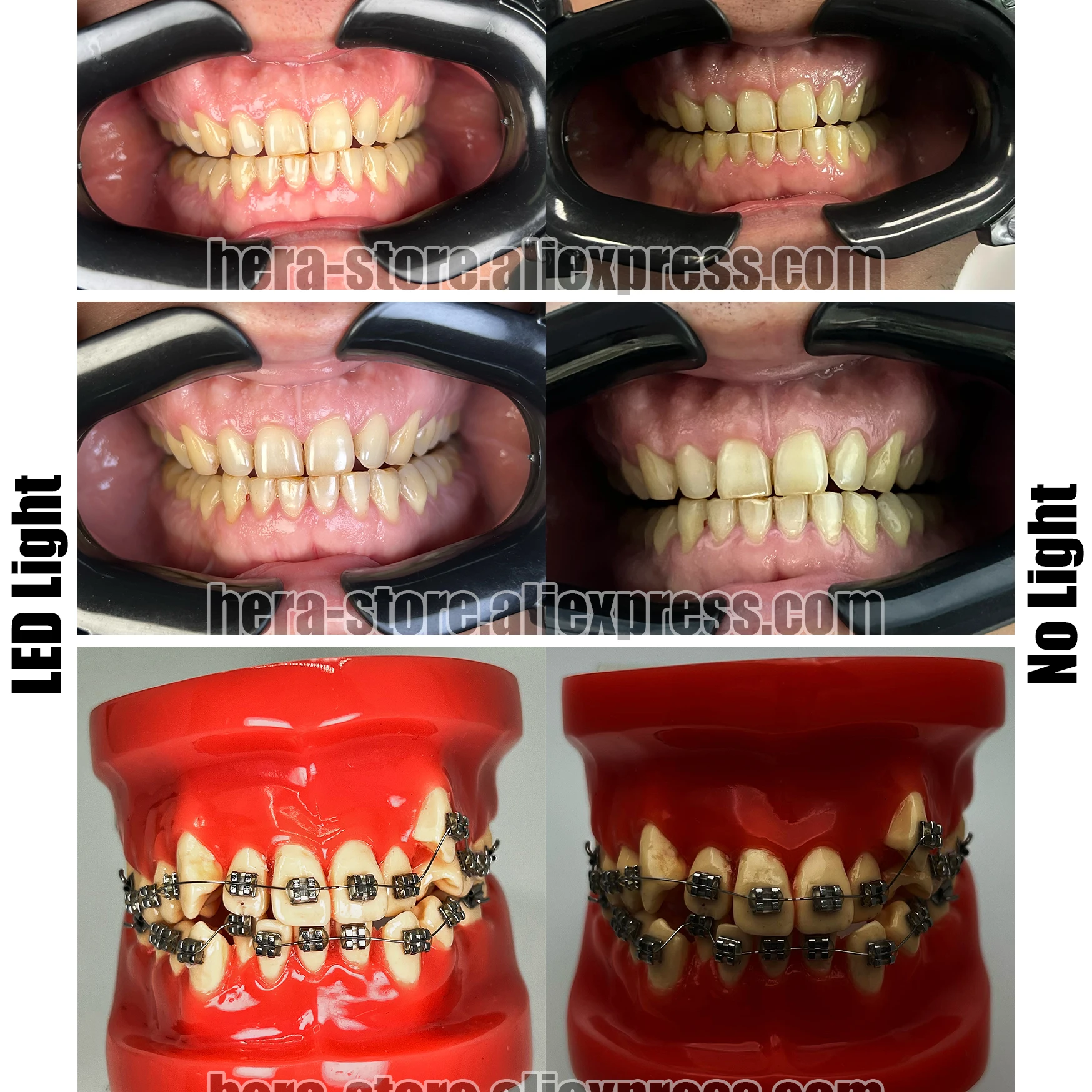 Ceny Pełne Stomatologiczne Ustne Wypełnienie światło Wewnątrzustny Sprzęt Fotograficzny Stomatologia Latarka Dla Dentystów Fotografia Makro