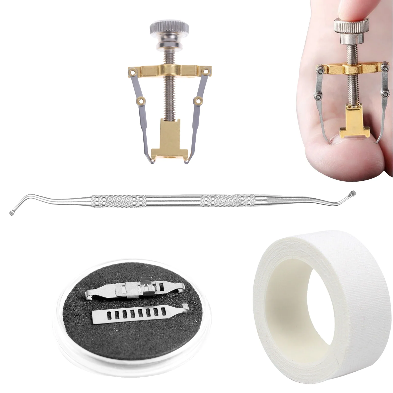 

Корректор для вросших ногтей набор для удаления вросших ногтей