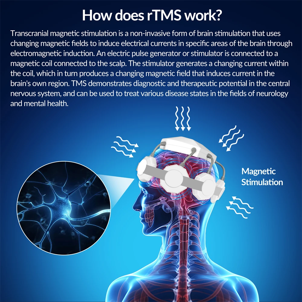 Аппарат для транскристальной магнитной стимуляции Dawfek Tms Therapy лечения инсульта