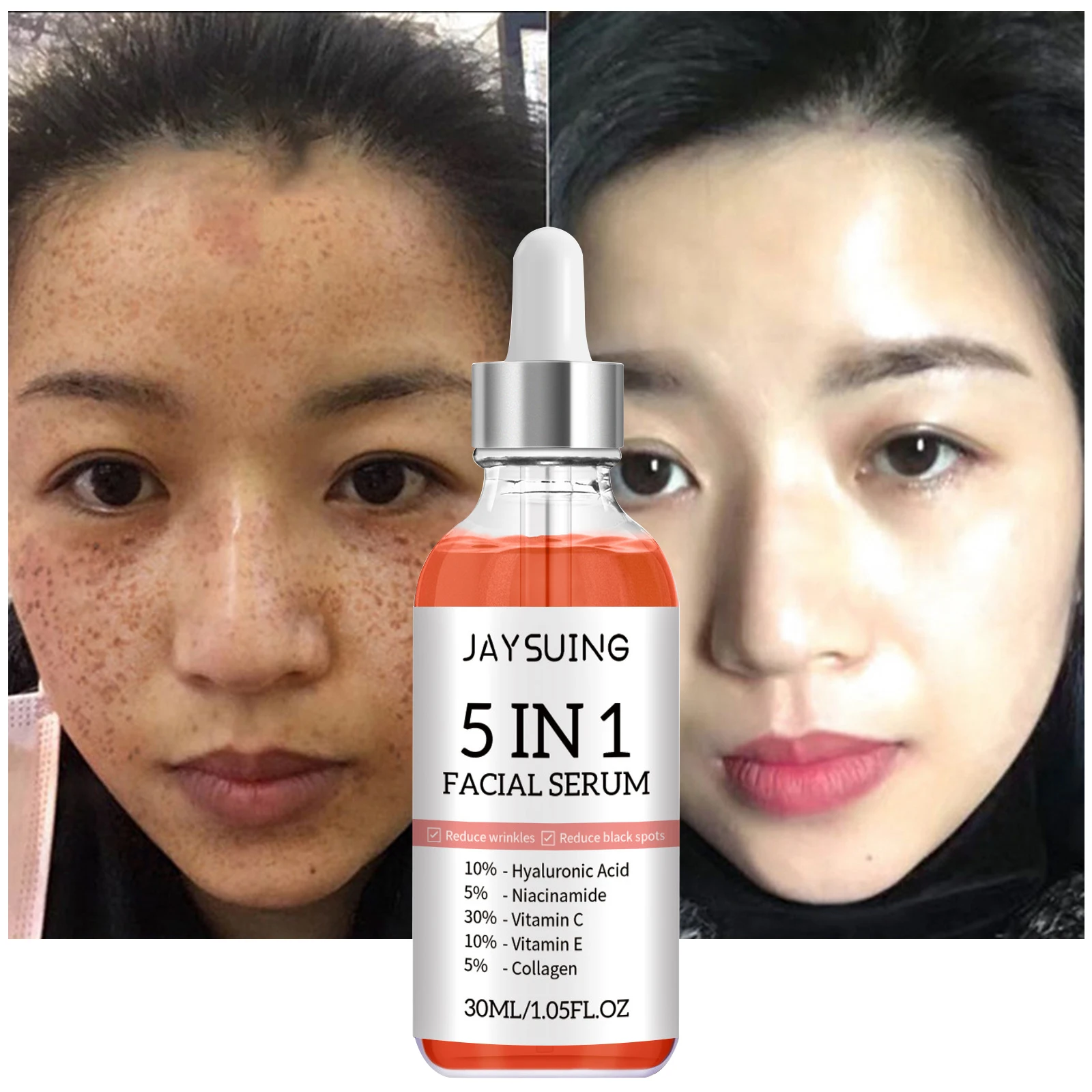 Отбеливающая сыворотка 5 в 1, с витамином против морщин и омоложения, увлажняющая Антивозрастная, для сужения пор, для осветления веснушек в темных тонах