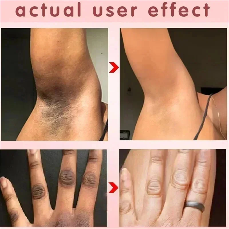 Крем для отбеливания подмышек внутри бедра локти колени увлажняющий крем тела с