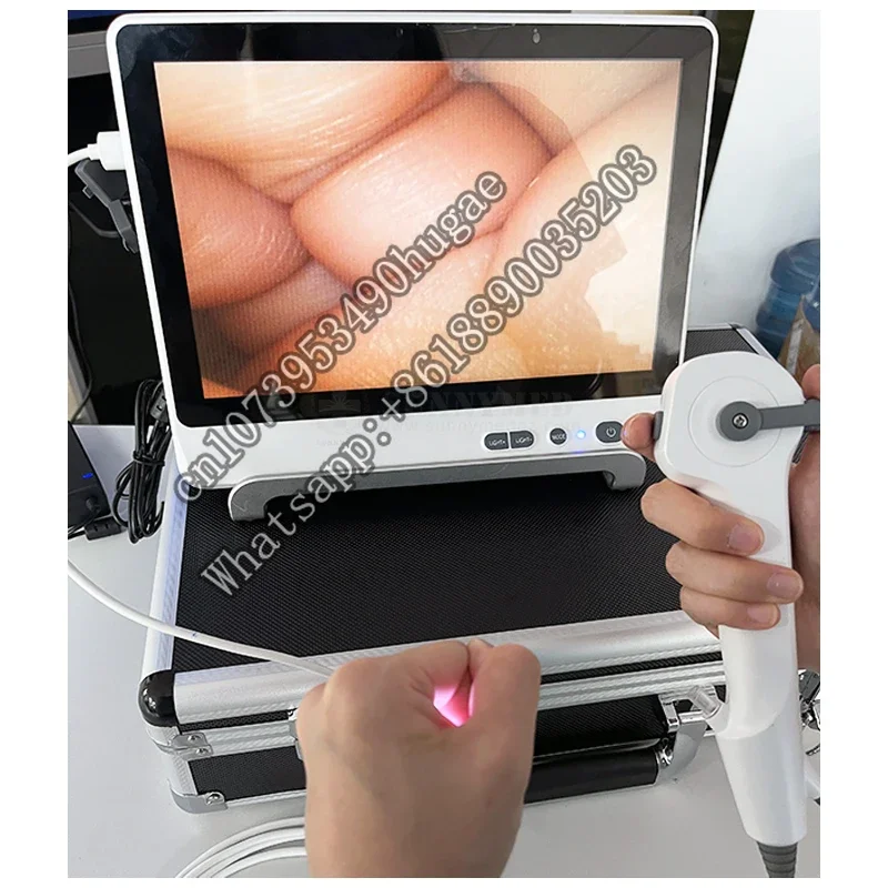 SY-P029-3 высококачественный одноразовый уретероскоп Полужесткий видео гибкий