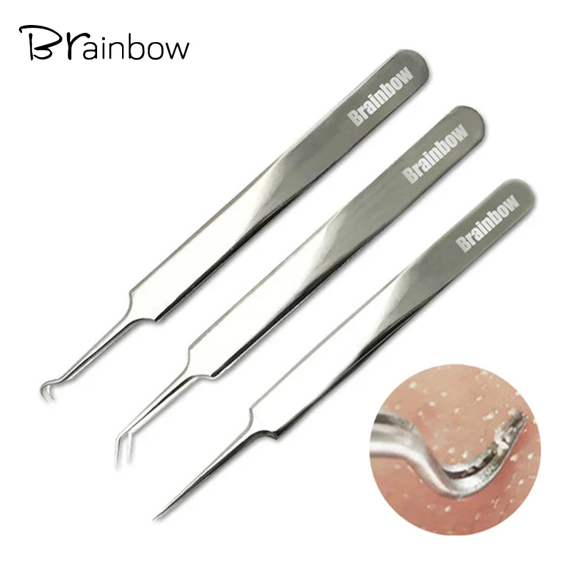 Brainbow 3 шт./упак. Черноголовых Пинцет и пятна удаления точки сгиба gib голову
