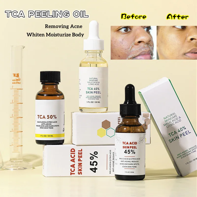 

TCA Peel Serum Skin Rejuvenating Essence Remove Acne Dead Skin Lightening Yellow Peeling Oil Bleaching Dark Moisturize Skin Care