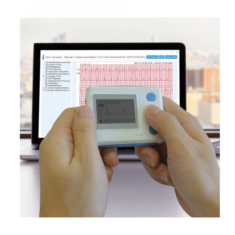 Hotler Dynamic 12 Leads channel Holter Supervise 48-hour continuous Supervising