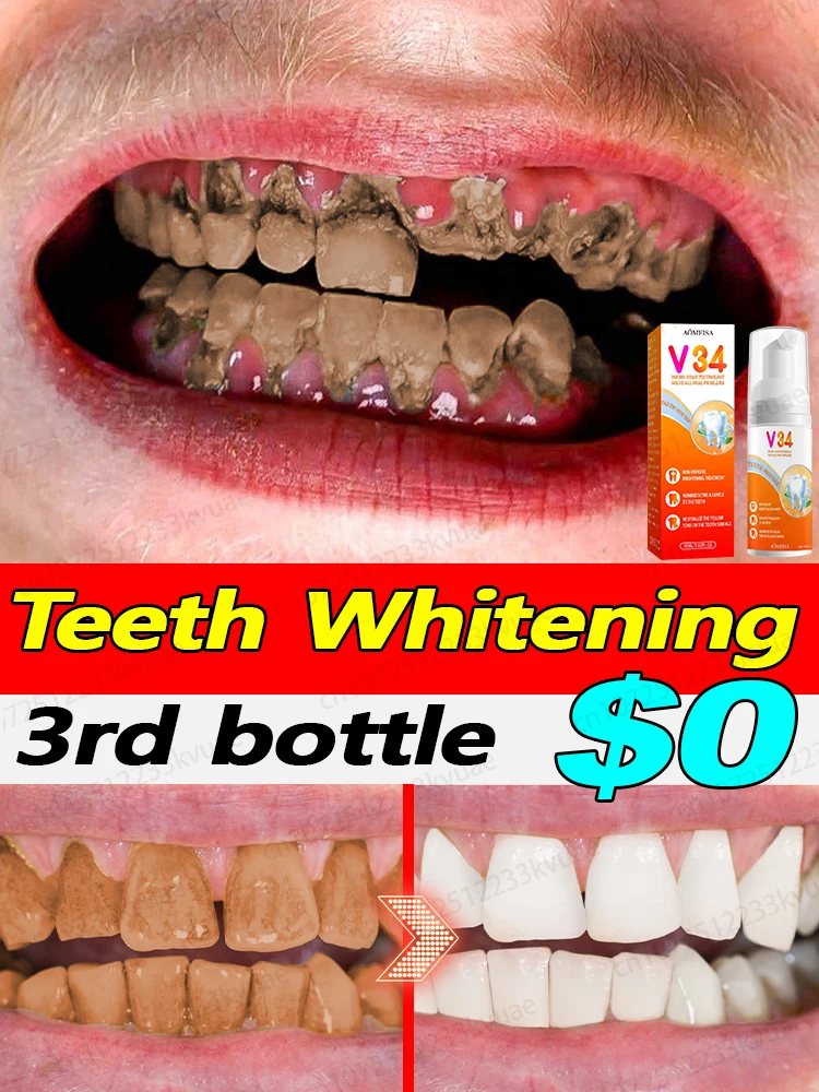 

Anti-cavity tooth decay fresh bad breath repair tooth decay remove plaque toothache relieve periodontitis