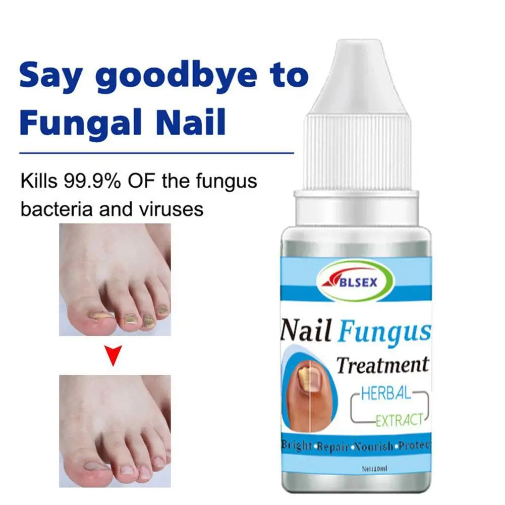 

Fungus Nails Treatment For Fingernails Toenails Repair Onychomycosis Paronychia Anti Infection Toe Nail Fungal Removal Liquid