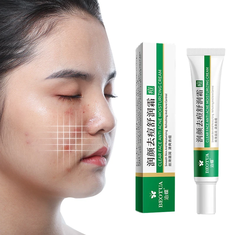 

Effective Acne Removal Cream Oil Control Repair Spots Acne Cream Skin Care Whitening Face Cream Moisturizing Face Gel Skin Care