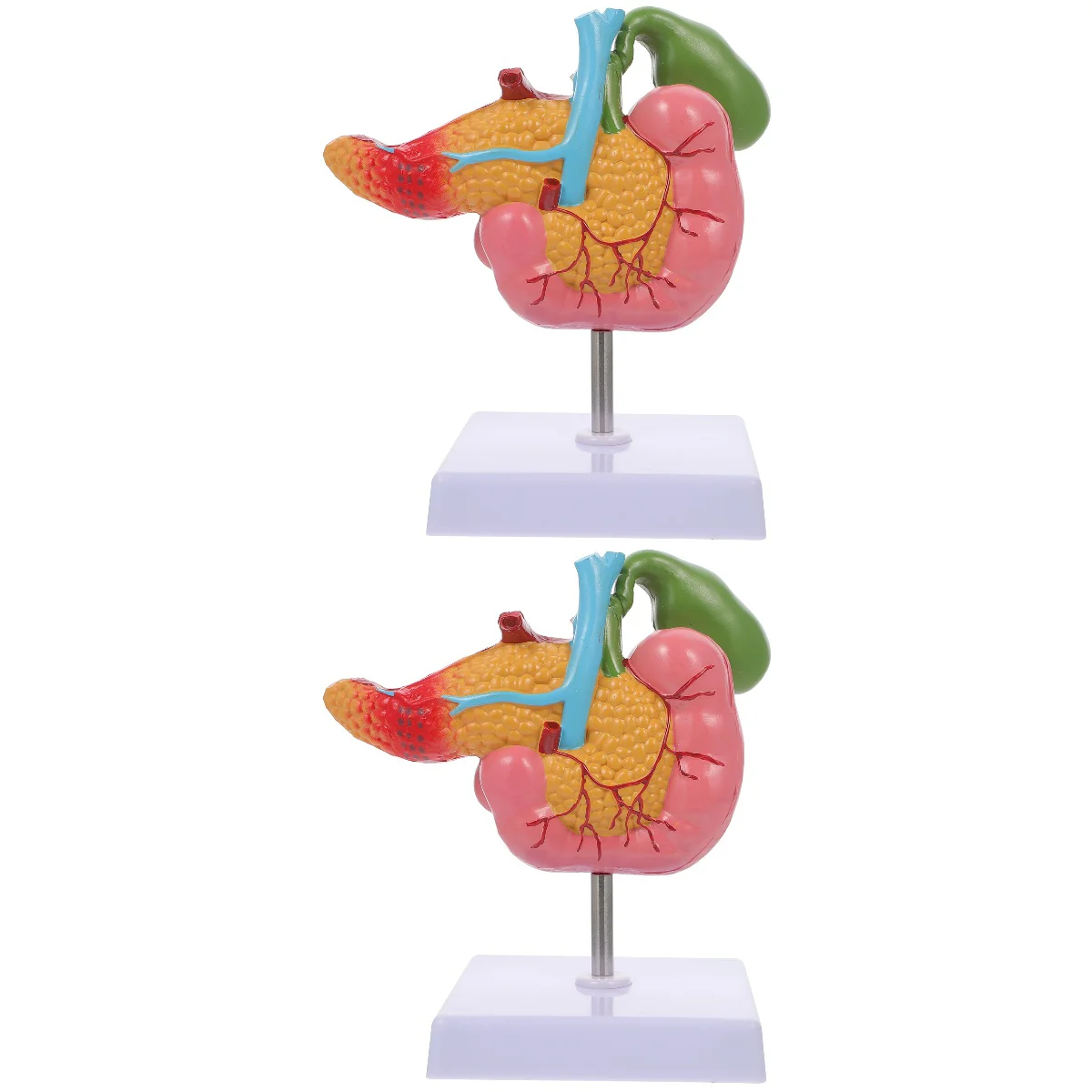 

2 Pieces Pathological Model Gallbladder Duodenum Lesion Biological Teaching Spleen Lesions Pancreas Duodenal