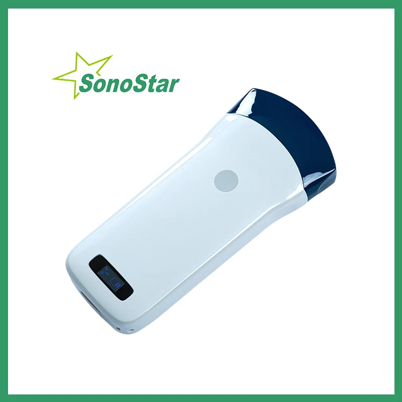 Фото Sonostar беспроводной ультразвуковой выпуклый зонд сканер портативный аппарат WIF USG ручной 3,5/5 МГц цветной доппплер 128 элемент sono №1