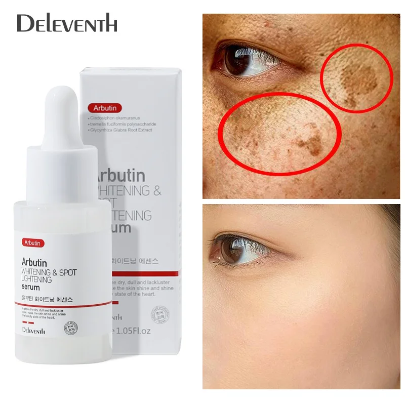 

Arbutin Whitening Freckle Face Serum Remove Melasma Essence Fade Dark Spots Melanin Brighten Skin Pigment Correction Products