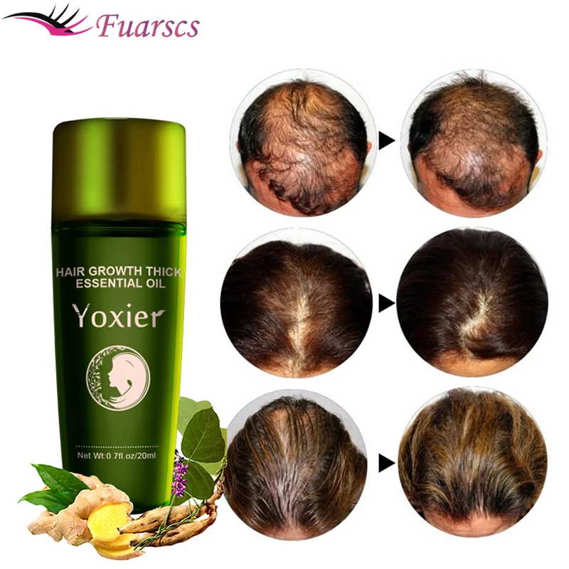 

Fast Hair Growth Serum Essential Oils Ginger Treatment Hair Loss Essence Nourishing Soften Scalp Repair Damaged Hair Care 20ml