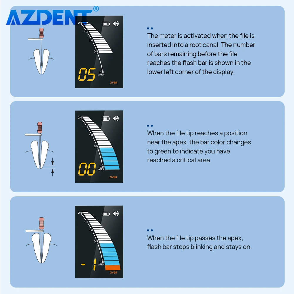 Локатор вершины корневых каналов зубов AZDENT Endo Apex Location умные портативные