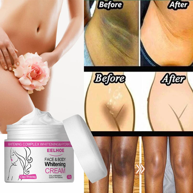 Effective Body Whitening Cream Bleaching Improve Underarm Armpit Ankles Elbow Knee Dull Moisturizing Brighten Korean Cosmetics