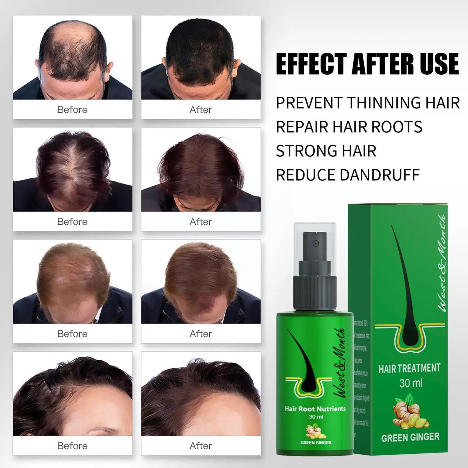 

Ginger Hair Growth Spray Essential Oils Hair Loss Treatment Fast Treatment Dry Frizzy Repair Hair Prevent Thinning Products T9y5