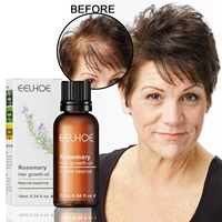 eelhoe fast regenerating anti hair loss rosemary hair restoring oil repair damaged hair care hair regenerating treatment oil 1ps