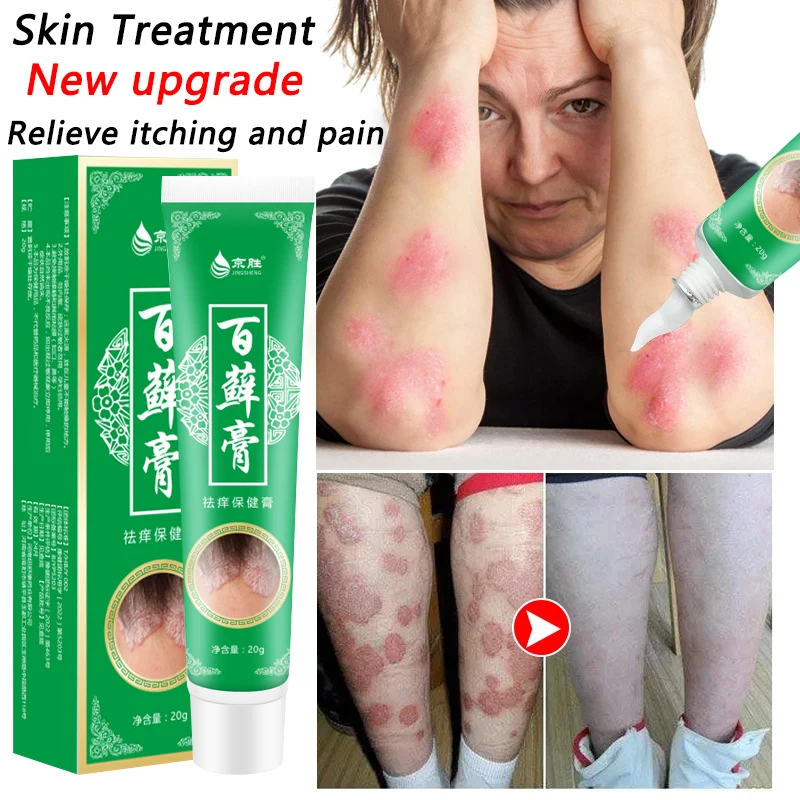 Новый обновленный травяной крем от псориаза