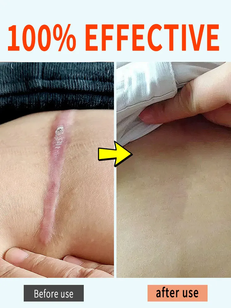 Скажи прощайте с низким содержанием самооцены и отвратитесь гладкую кожу