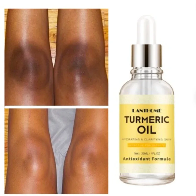 

New Turmeric Oil Glow to Facial Lightening Brightening Serum For Black Brown Skin Leg Hand Body Whitening for Dark Skin