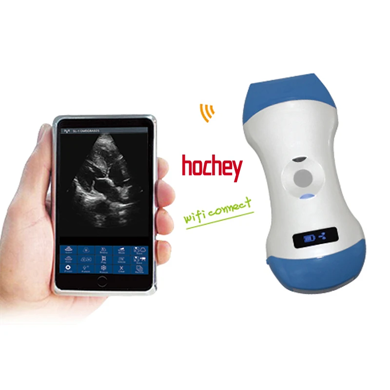 

HOCHEY MEDICAL 192 Elements беспроводной выпуклый линейный ультразвуковой зонд