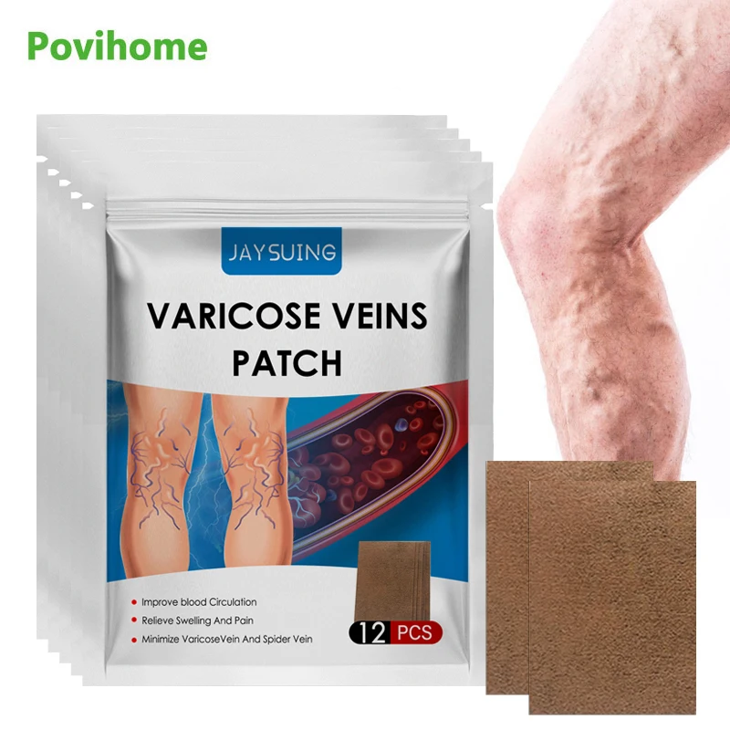 

12Pcs/Bag Varicose Veins Patch Treat Vasculitis Phlebitis Sticker Leg Spider Removal Swelling Pain Relief Herbal Medical Plaster