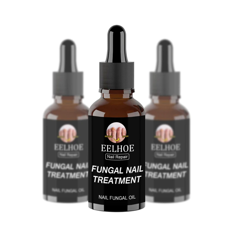 

Fast Fungal Nail Treatments Serum Onychomycosis Paronychia Anti-Fungal Nail Sensitive Herb Toe Fungus Foot Repair Essences Care