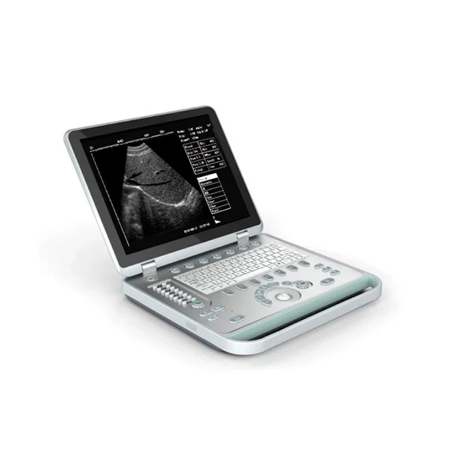 

Portable B type scanner ultrasound wireless color scanner