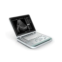 portable b type scanner ultrasound wireless color scanner