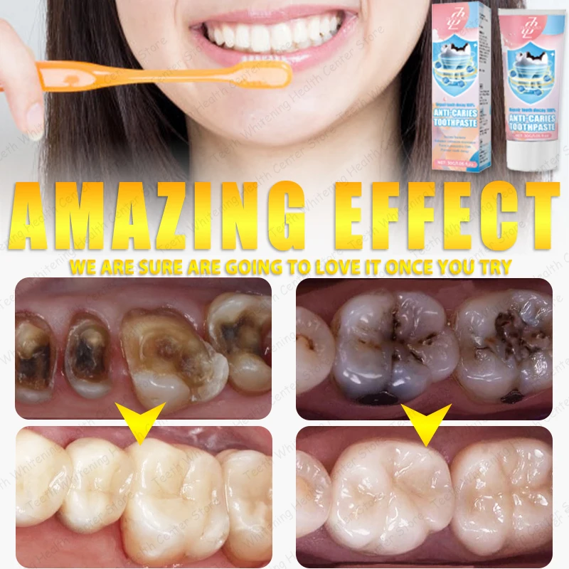 99 9% Teknik sazi azi אור