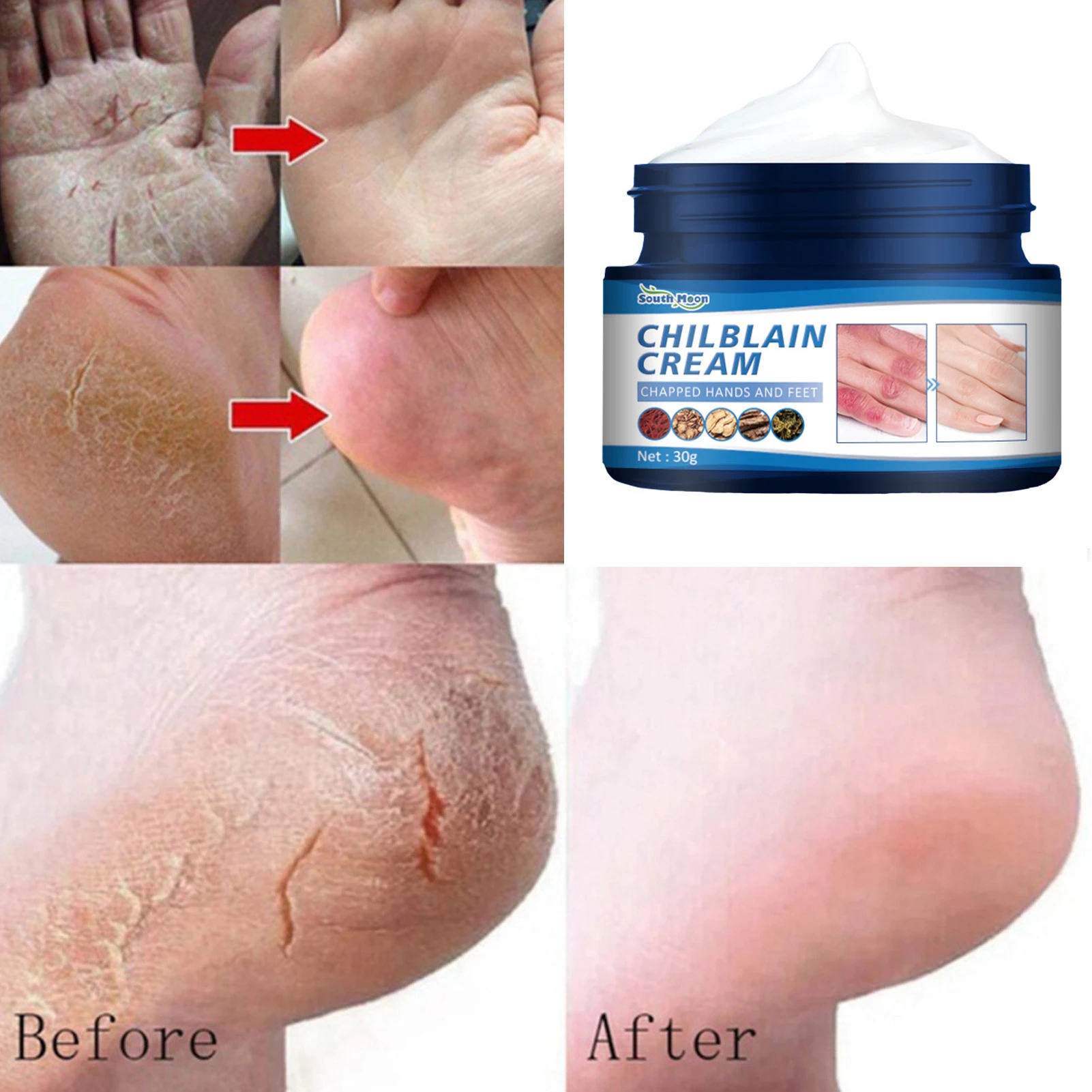

Herbal Anti Crack Foot Cream Anti-Drying Heel Cracked Repair Calluses Dead Skin Removal Foot Mask Moisturizing Hand Feet Care