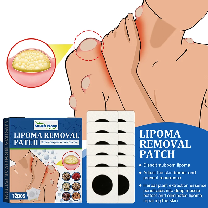 

Lipoma Removal Cream Antitumor Remove Fat Lump Ointment Nodular Discomfort Skin Cyst Swelling Pain Relief Herbs Plaster Care