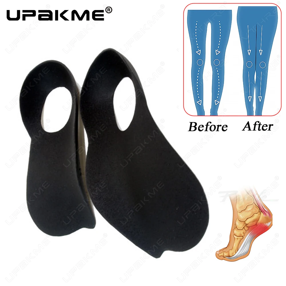 

UPAKME Orthopedic OX-shaped Legs Insoles For Shoes Half Pad Flat Foot Arch Support Plantar Fasciitis Valgus Varus Pads Cushions
