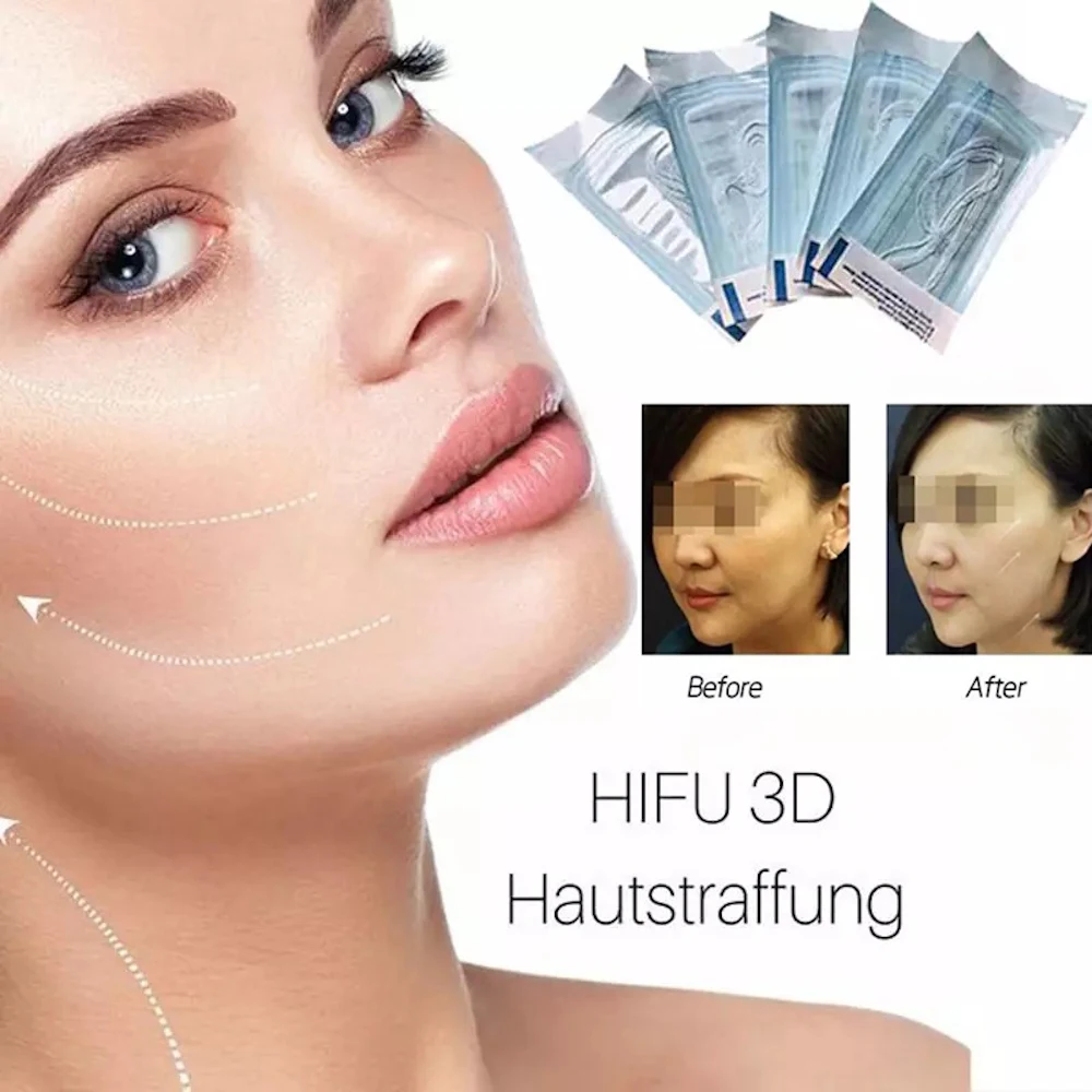 

Radar Thread No Needle Silk Fibroin Line Carved Protein Line Collagen for Facial Lift Anti Aging Hyaluronic Tightening Skin Care