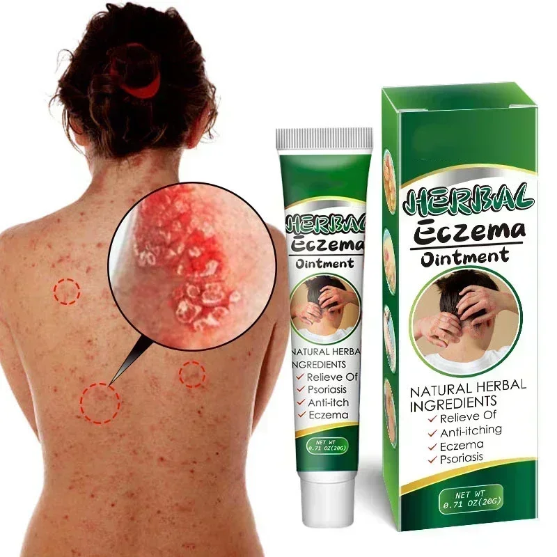 Китайская Антибактериальная мазь на основе лекарственных трав при псориазе Eczma Itchy (art.: 3920c99fe41aa) - 3920c99fe41aa